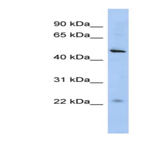 anti-Chromosome 12 Open Reading Frame 50 (C12ORF50) (N-Term) antibody avatar