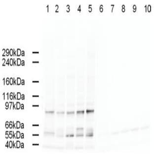 anti-Adaptor-Related Protein Complex 2, alpha 2 Subunit (AP2A2) (AA 3-14) antibody avatar