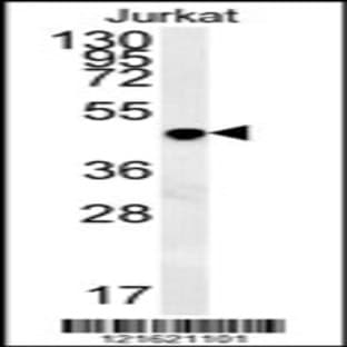anti-D-Amino-Acid Oxidase (DAO) (AA 259-287), (Center) antibody avatar