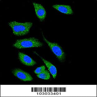 anti-Death-Associated Protein Kinase 1 (DAPK1) (C-Term), (AA 1360-1389) antibody avatar