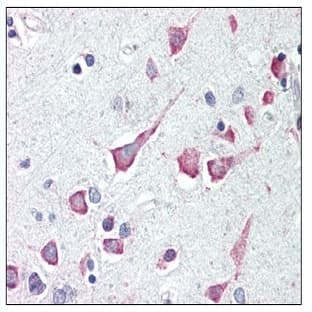 anti-Death-Associated Protein Kinase 3 (DAPK3) (Center) antibody avatar