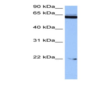 anti-Chromosome 14 Open Reading Frame 174 (C14orf174) (N-Term) antibody avatar