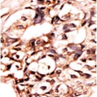 anti-Death-Domain Associated Protein (DAXX) (pSer213) antibody avatar