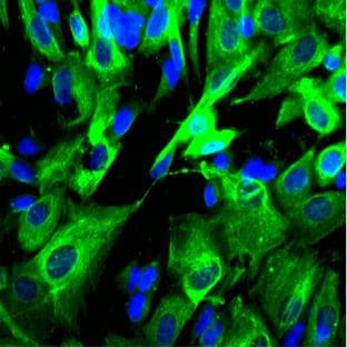anti-Adaptor-Related Protein Complex 2, beta 1 Subunit (AP2B1) (AA 75-245) antibody avatar