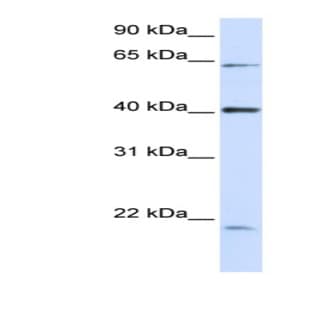 anti-Chromosome 19 Open Reading Frame 46 (C19orf46) (N-Term) antibody avatar