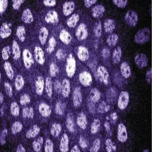 anti-Damage-Specific DNA Binding Protein 1, 127kDa (DDB1) (AA 739-935) antibody avatar