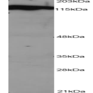 anti-Damage-Specific DNA Binding Protein 1, 127kDa (DDB1) (C-Term) antibody avatar