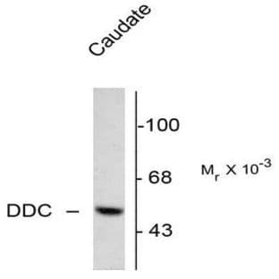 anti-Dopa Decarboxylase (Aromatic L-Amino Acid Decarboxylase) (DDC) (N-Term) antibody avatar