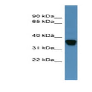 anti-Dihydrodiol Dehydrogenase (DDH) (N-Term) antibody