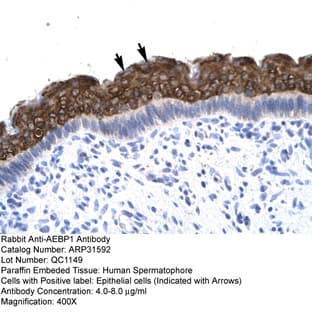 anti-AE Binding Protein 1 (AEBP1) (N-Term) antibody avatar