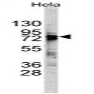 anti-DEAD (Asp-Glu-Ala-Asp) Box Polypeptide 3, X-Linked (DDX3X) (C-Term) antibody avatar