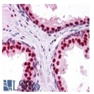 anti-DEAD (Asp-Glu-Ala-Asp) Box Polypeptide 5 (DDX5) (C-Term) antibody avatar