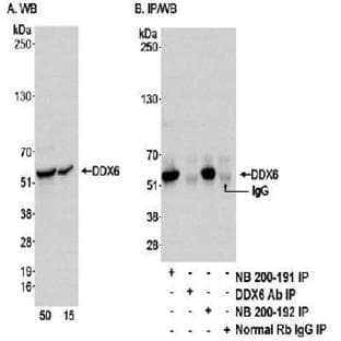 anti-DEAD (Asp-Glu-Ala-Asp) Box Polypeptide 6 (DDX6) antibody avatar