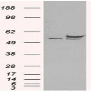 anti-DEAD (Asp-Glu-Ala-Asp) Box Polypeptide 6 (DDX6) (C-Term) antibody avatar