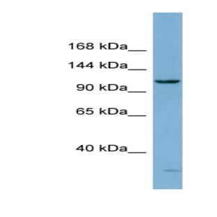 anti-DEAH (Asp-Glu-Ala-His) Box Polypeptide 15 (DHX15) (N-Term) antibody avatar