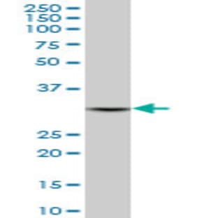 anti-2,4-Dienoyl CoA Reductase 1, Mitochondrial (DECR1) (AA 236-336) antibody avatar