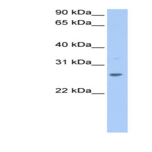anti-Cysteine-Rich Secretory Protein 1 (CRISP1) (N-Term) antibody avatar