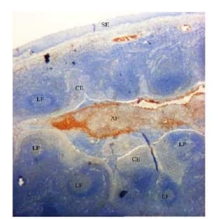 anti-Defensin beta 4 (DEFB4) (AA 3-39) antibody avatar