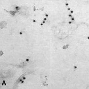 anti-Linker For Activation of T Cells (LAT) antibody avatar