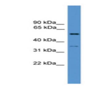 anti-Coagulation Factor C Homolog, Cochlin (Limulus Polyphemus) (COCH) (N-Term) antibody avatar
