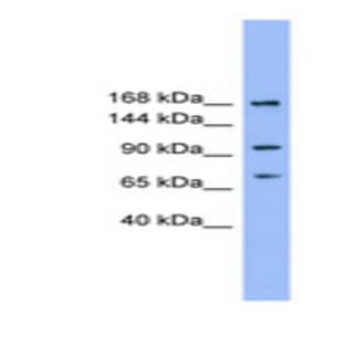 anti-ADAM Metallopeptidase with Thrombospondin Type 1 Motif, 19 (ADAMTS19) (N-Term) antibody avatar