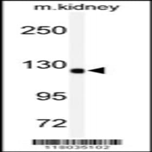 anti-ADAM Metallopeptidase with Thrombospondin Type 1 Motif, 19 (ADAMTS19) (AA 298-328), (Center) antibody avatar
