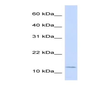 anti-Cellular Retinoic Acid Binding Protein 2 (CRABP2) (Middle Region) antibody avatar