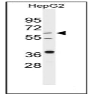 anti-24-Dehydrocholesterol Reductase (DHCR24) (Middle Region) antibody avatar