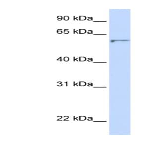 anti-24-Dehydrocholesterol Reductase (DHCR24) (N-Term) antibody avatar