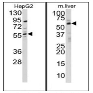 anti-24-Dehydrocholesterol Reductase (DHCR24) (N-Term) antibody avatar