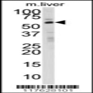 anti-24-Dehydrocholesterol Reductase (DHCR24) (N-Term), (AA 57-87) antibody avatar