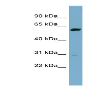 anti-24-Dehydrocholesterol Reductase (DHCR24) (Middle Region) antibody avatar