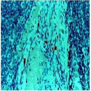 anti-Chymase 1, Mast Cell (CMA1) antibody avatar
