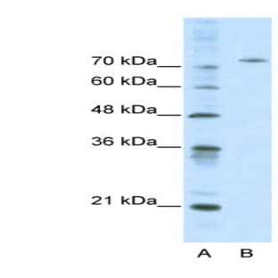 anti-Afamin (AFM) (Middle Region) antibody avatar