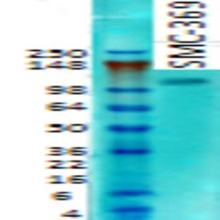 anti-Discs, Large Homolog 1 (Drosophila) (DLG1) (AA 1-104) antibody