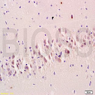 anti-Discs, Large Homolog 4 (Drosophila) (DLG4) antibody