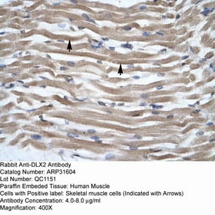 anti-Distal-Less Homeobox Protein 2 (N-Term) antibody