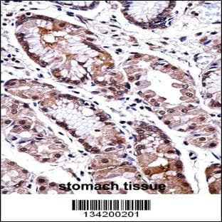 anti-Distal-Less Homeobox 5 (DLX5) (AA 100-128), (Center) antibody