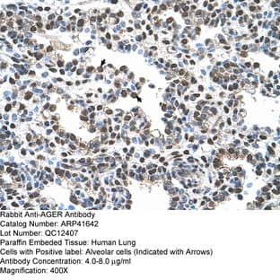 anti-Advanced Glycosylation End Product-Specific Receptor (AGER) (C-Term) antibody avatar