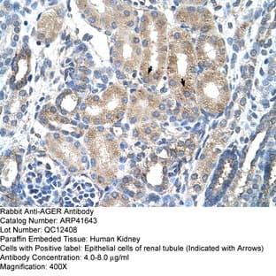 anti-Advanced Glycosylation End Product-Specific Receptor (AGER) (C-Term) antibody avatar