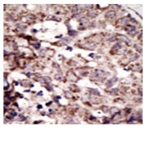 anti-Advanced Glycosylation End Product-Specific Receptor (AGER) (N-Term) antibody avatar