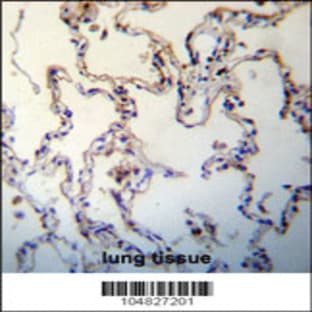 anti-Advanced Glycosylation End Product-Specific Receptor (AGER) (C-Term), (AA 348-378) antibody avatar