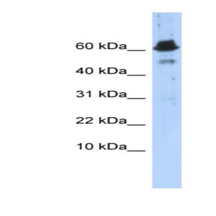 anti-4-Aminobutyrate Aminotransferase (ABAT) (Middle Region) antibody avatar