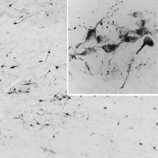 anti-Agouti Related Protein Homolog (Mouse) (AGRP) (C-Term) antibody avatar