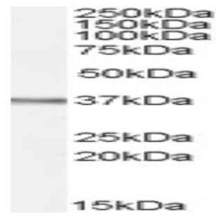 anti-8-Oxoguanine DNA Glycosylase (OGG1) (Internal Region) antibody avatar