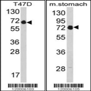 anti-Endothelin-Converting Enzyme 1 (ECE1) (AA 392-419), (Center) antibody avatar