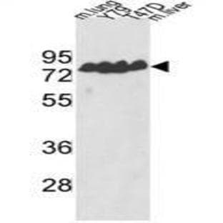 anti-Endothelin-Converting Enzyme 1 (ECE1) (Middle Region) antibody avatar