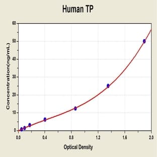 Thymidine Phosphorylase (TYMP) ELISA Kit avatar