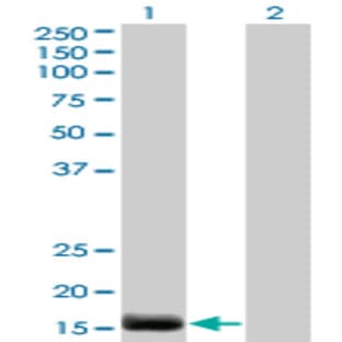 anti-Endothelin 2 (EDN2) (AA 1-179) antibody avatar