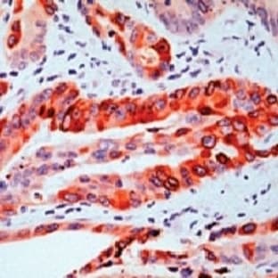 anti-Prostaglandin-Endoperoxide Synthase 2 (Prostaglandin G/H Synthase and Cyclooxygenase) (PTGS2) (C-Term) antibody avatar